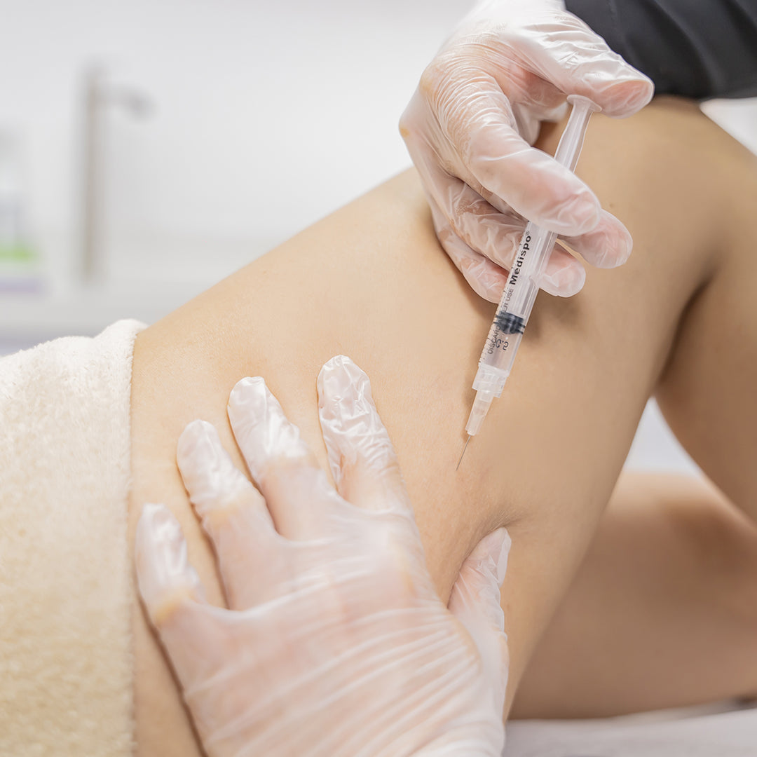 TRATAMIENTO PARA CELULITIS